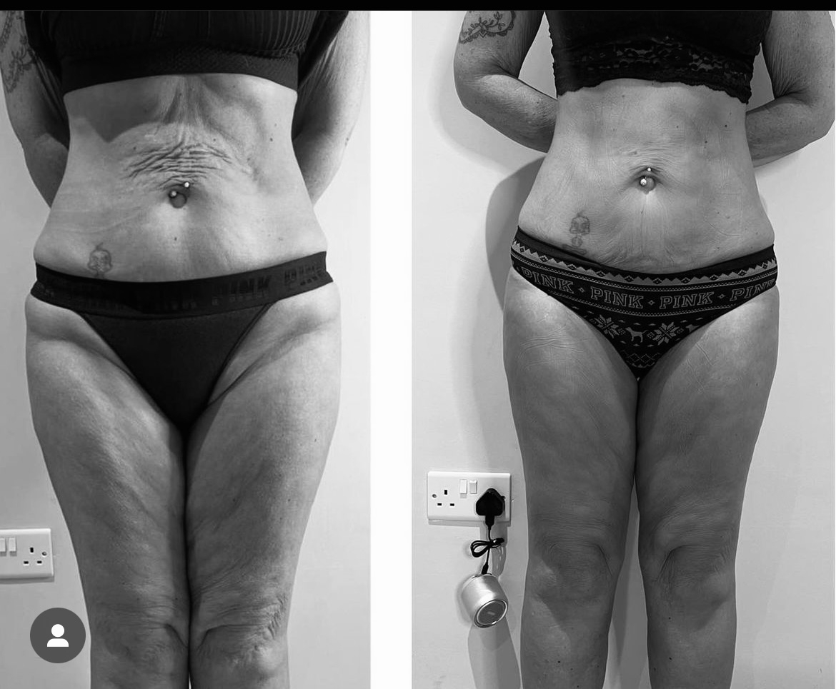 WhatsApp Image 2023-01-11 at 6.22.34 PM